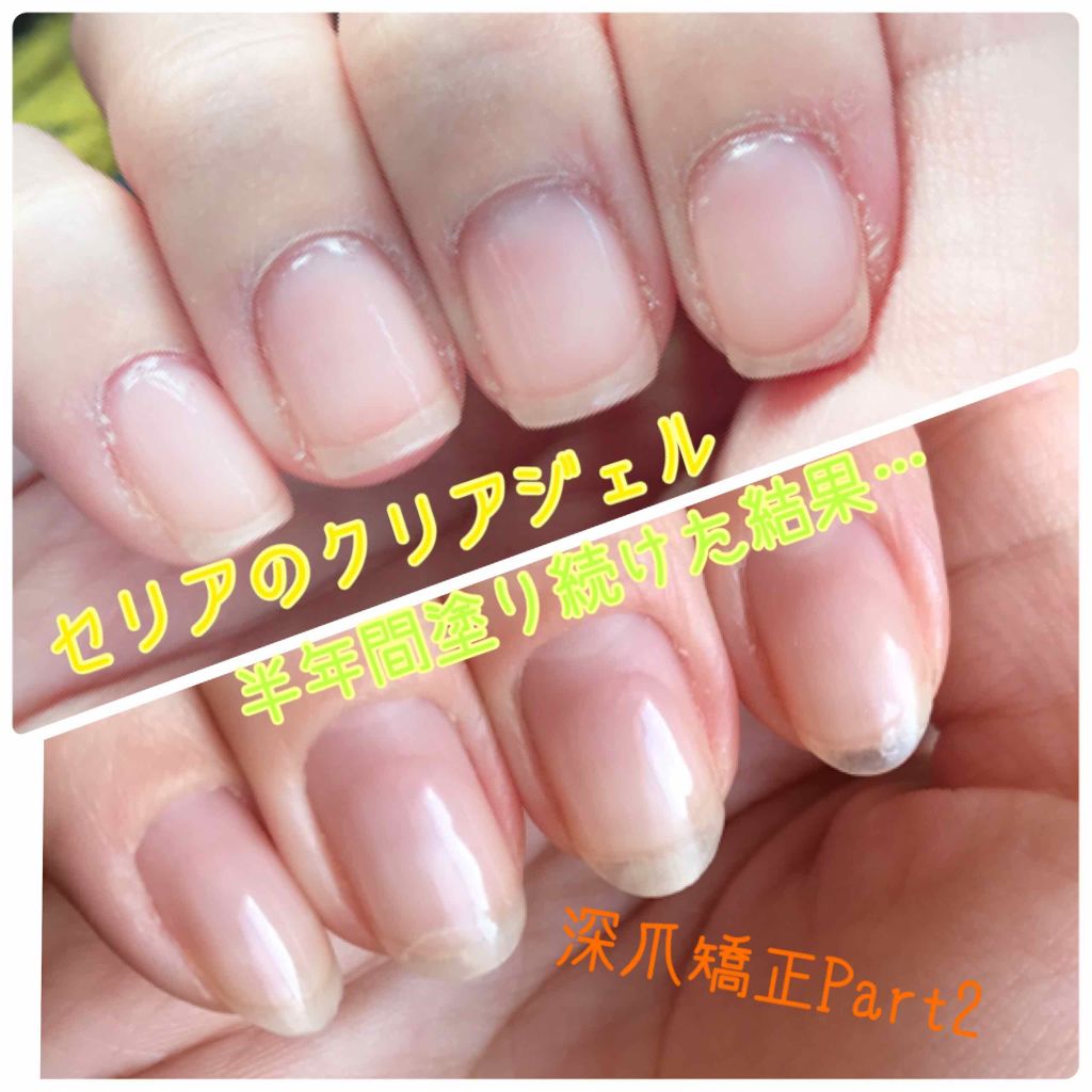 ネイル キューティクルオイル キューティクルズを使った口コミ 自己流育爪法4月から6ヶ月間 セリアのジェ By Mint 乾燥肌 代後半 Lips