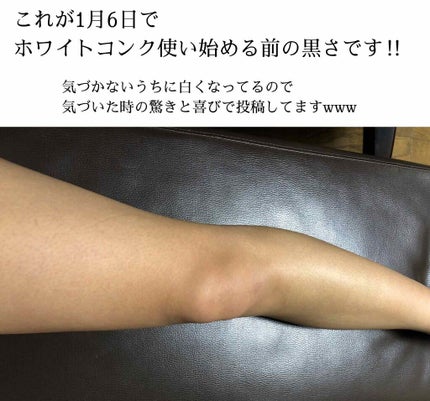 ケアノキュア(医薬品)/小林製薬/その他を使ったクチコミ(3枚目)