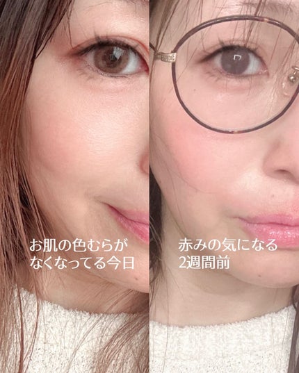 PDRNショット675/COSNORI/美容液を使ったクチコミ(3枚目)