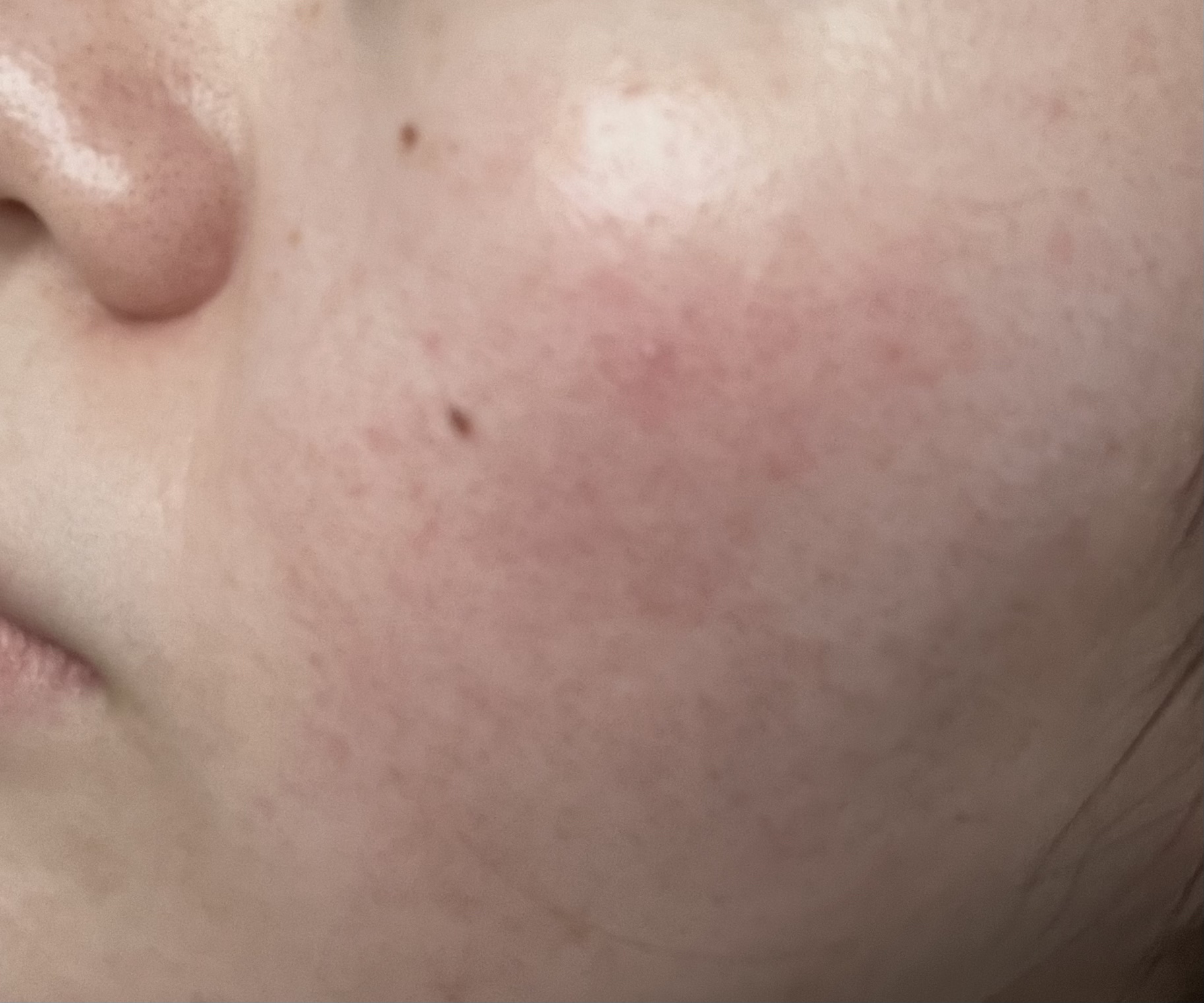 ディープモイスト ローション D/アベンヌ/化粧水を使ったクチコミ（2枚目）