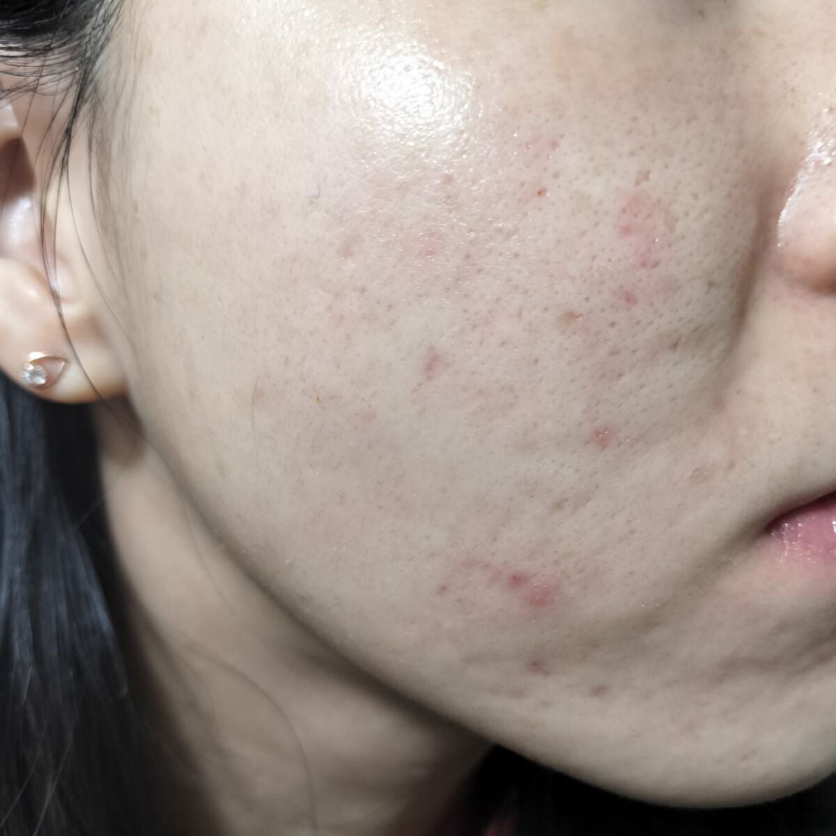 miina@汚肌工事録⚠️ on LIPS 「10/8の#汚肌工事録いつもありがとう💝/え?なんか久しぶりの..」(1枚目)