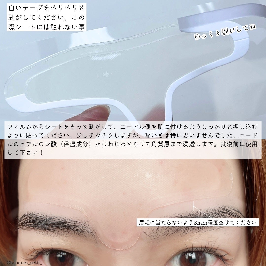 メディリフト マイクロフィラー フォアヘッド/YA-MAN TOKYO JAPAN/頭皮ケアを使ったクチコミ(4枚目)