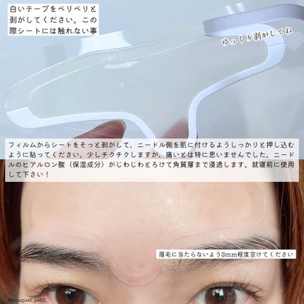 メディリフト マイクロフィラー フォアヘッド/YA-MAN TOKYO JAPAN/頭皮ケアを使ったクチコミ(4枚目)