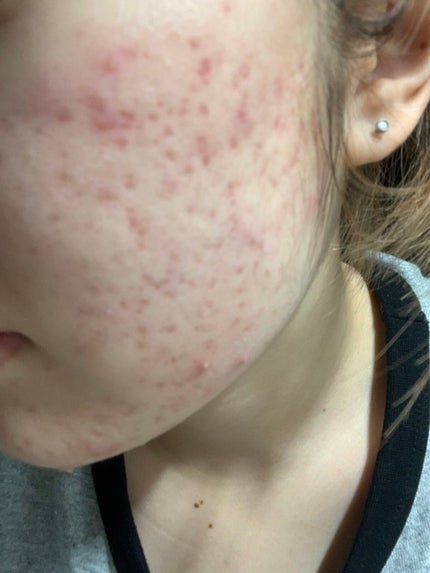 を使ったクチコミ(2枚目)