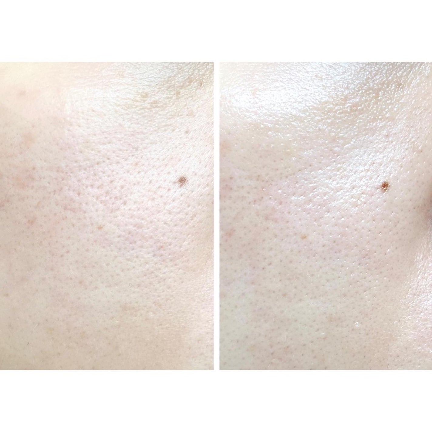 まる on LIPS 「人気のビタCシリーズの美白クリーム⠜65,000PPM高濃度..」(5枚目)