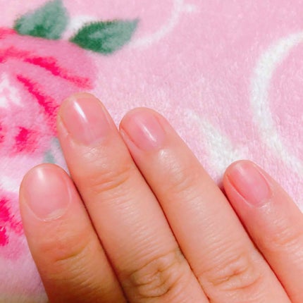 ネイルトリートメントジェルD/DAISO/ネイルオイル・トリートメントを使ったクチコミ(1枚目)