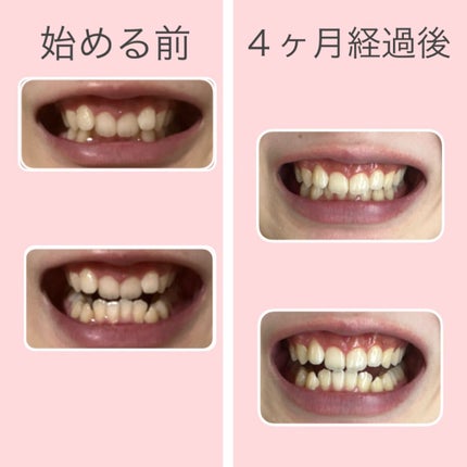 を使ったクチコミ(2枚目)
