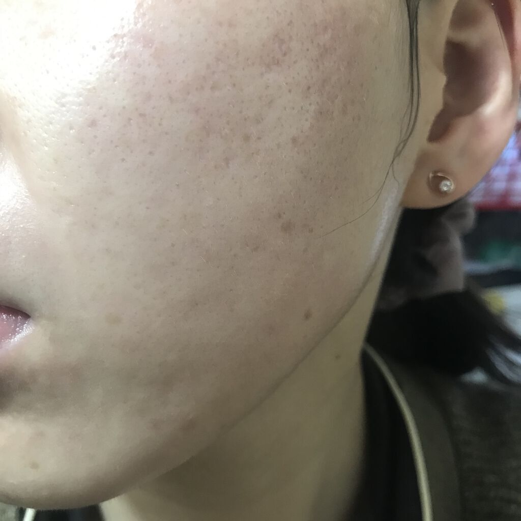 レチノールA 1% アドバンスドリバイタリゼーションクリーム/Life-flo/フェイスクリームを使ったクチコミ（2枚目）