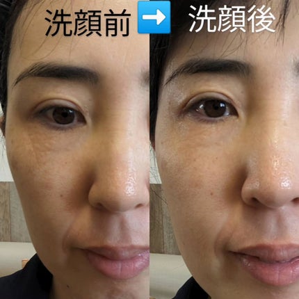 アミノネクリアウォッシュ/Cure/洗顔フォームを使ったクチコミ(6枚目)