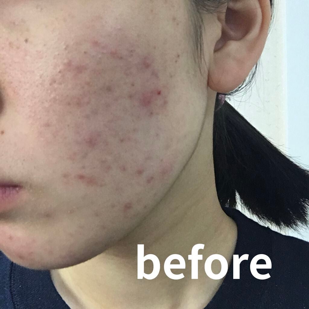 薬用ローション(とてもしっとり)/IHADA/化粧水を使ったクチコミ(2枚目)