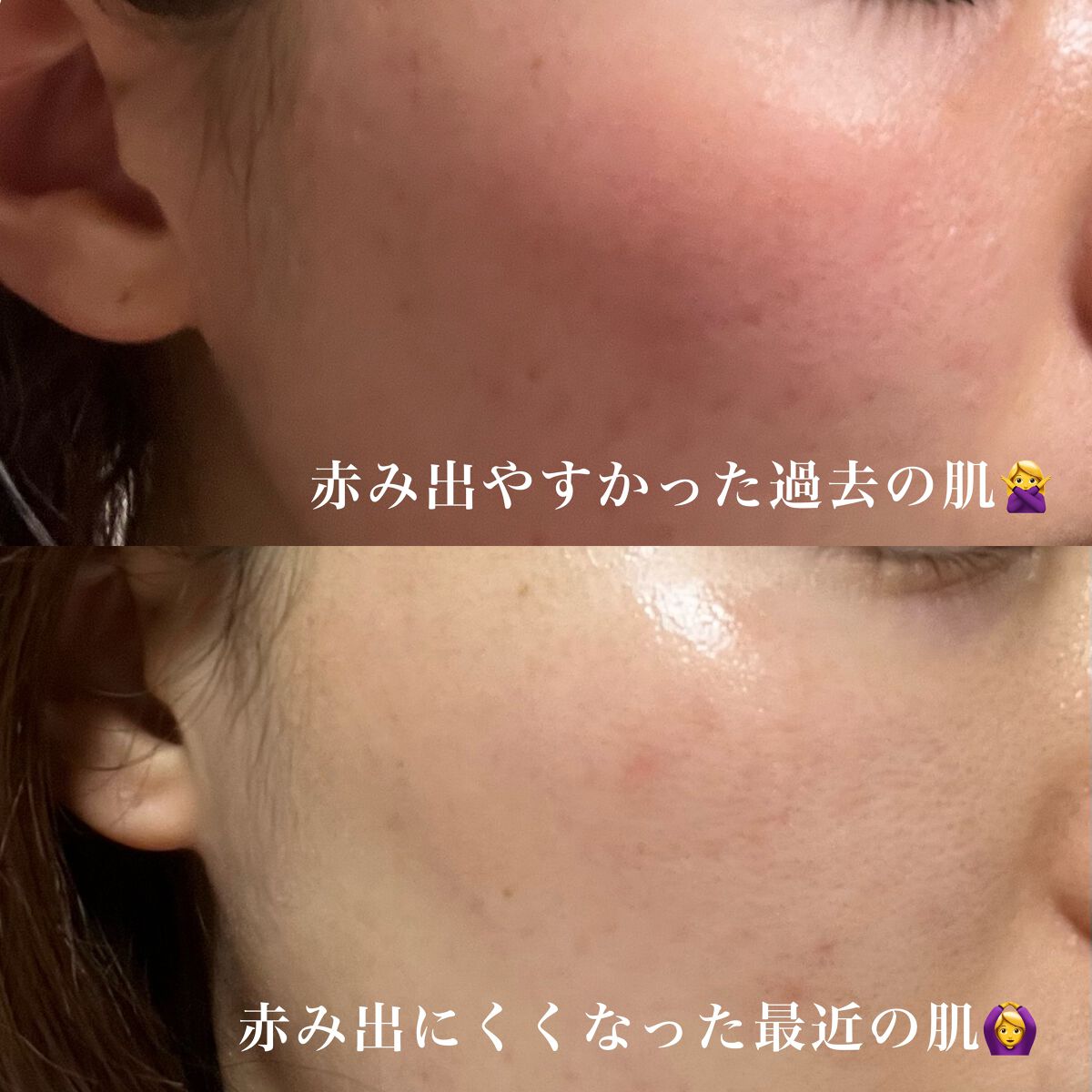 ブルーブライトナイトクリーム/EMROSÉ/フェイスクリームを使ったクチコミ（2枚目）