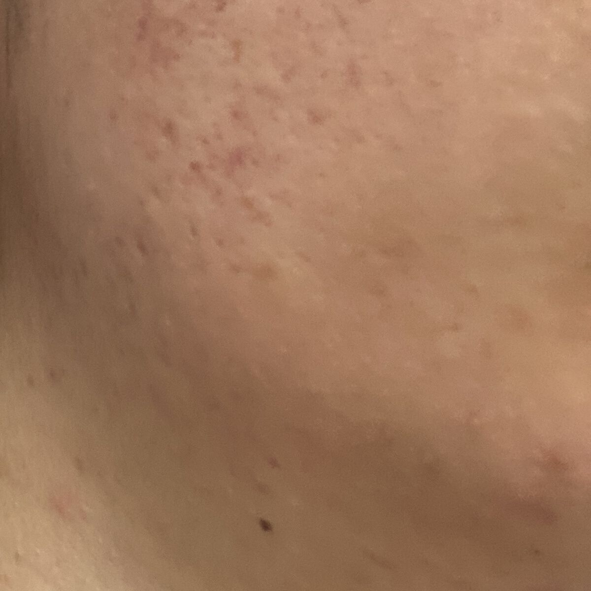 薬用しみ対策 美白化粧水 170mL（つめかえ用）/メラノCC/化粧水を使ったクチコミ（3枚目）