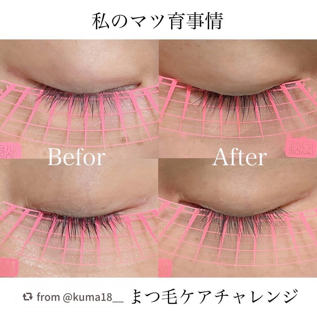 スカルプD ボーテ ピュアフリーアイラッシュセラム プレミアム/アンファー(スカルプD)/まつげ美容液を使ったクチコミ(1枚目)