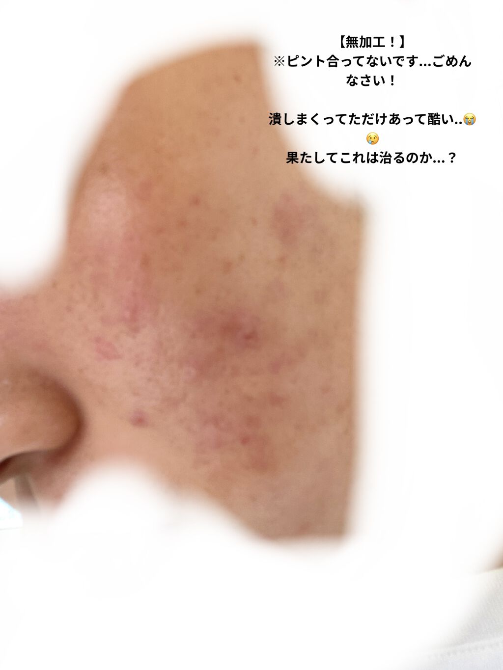 ロゼット洗顔パスタ アクネクリア/ロゼット/洗顔フォームを使ったクチコミ（2枚目）