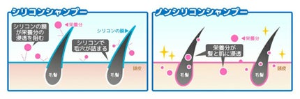 エクストラダメージケア デイリー補修トリートメント/パンテーン/洗い流すヘアトリートメントを使ったクチコミ(2枚目)