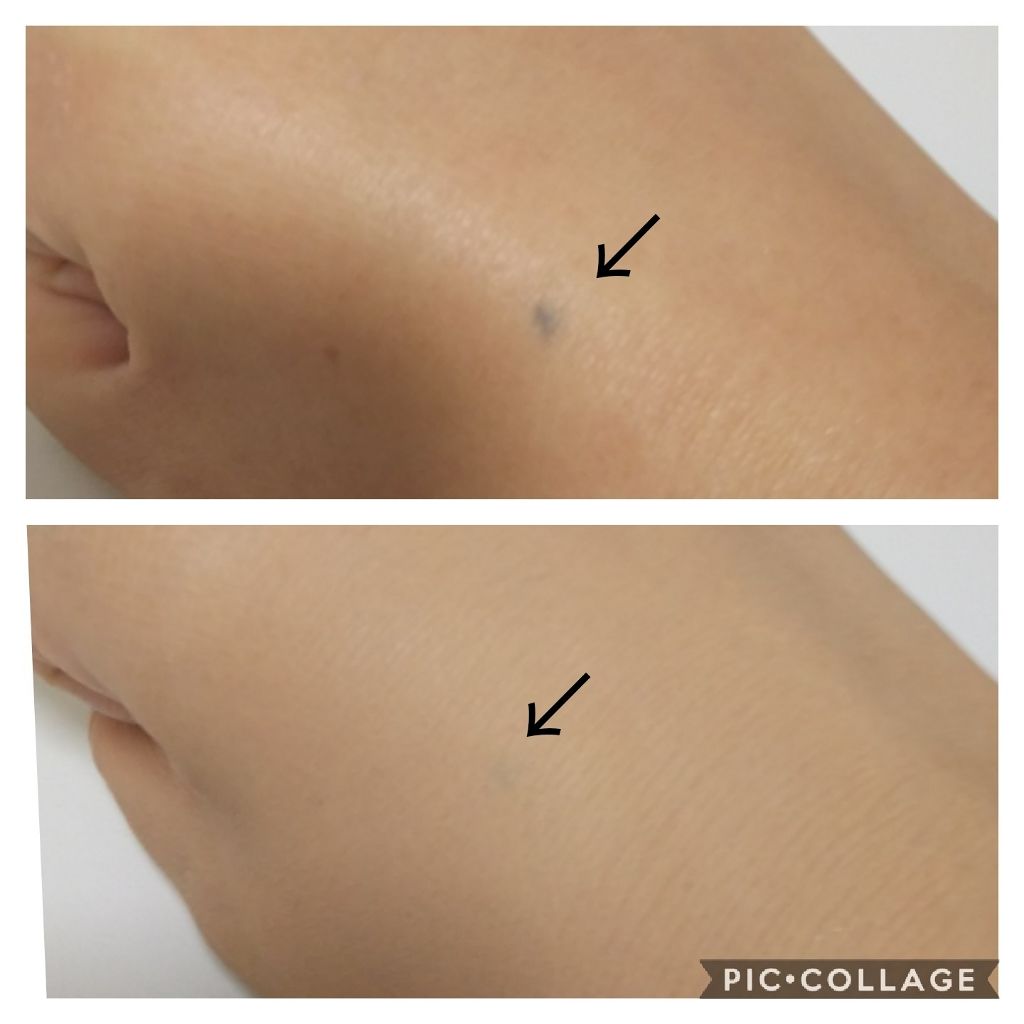 フローレス フィット/COVERMARK/クリーム・エマルジョンファンデーションを使ったクチコミ（2枚目）