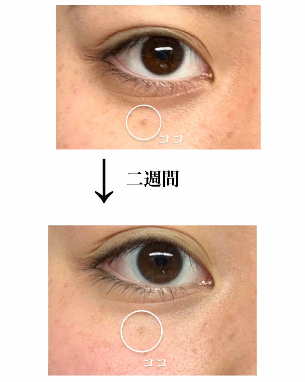 薬用 しみ 集中対策 美容液/メラノCC/美容液を使ったクチコミ（2枚目）