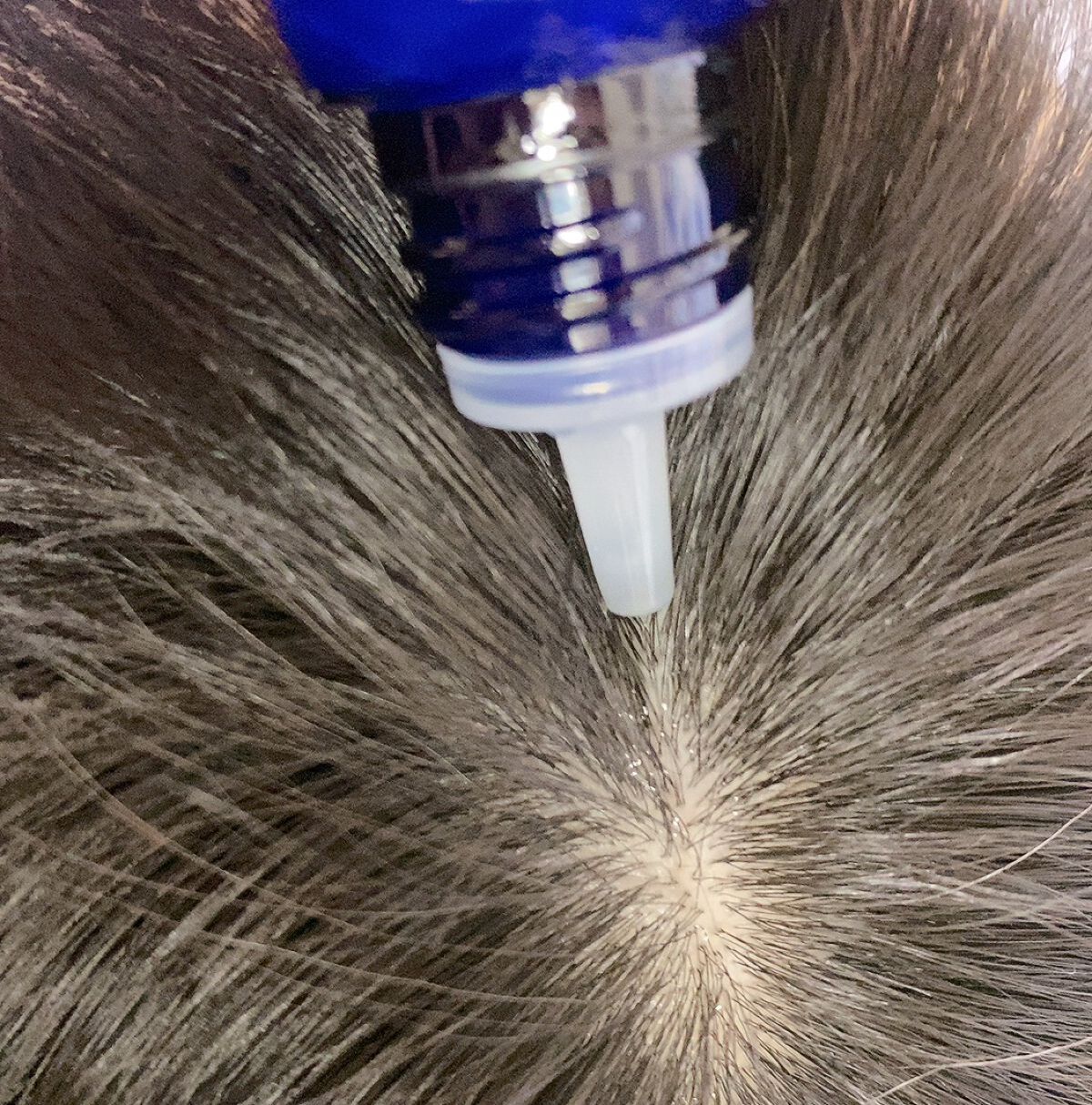 Wアプローチヘアプログラム/MUNOAGE(ミューノアージュ)/頭皮ローションを使ったクチコミ(6枚目)