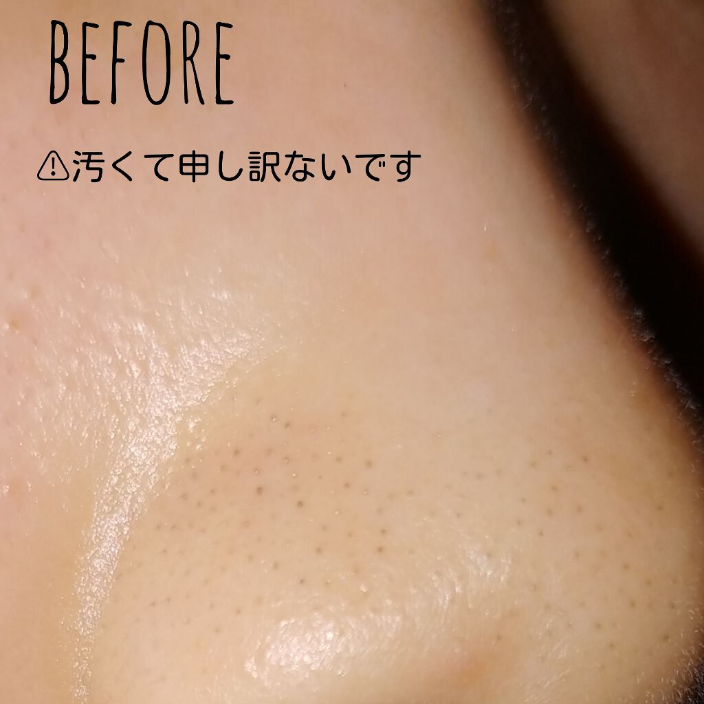 毛穴つるつるクレイパック/ボタニカルフォース/洗い流すパック・マスクを使ったクチコミ（2枚目）