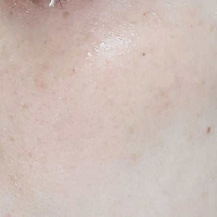 センテラ アンプルフォーム/SKIN1004/洗顔フォームを使ったクチコミ(6枚目)