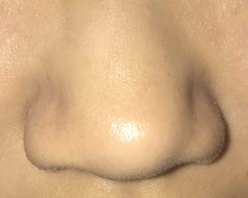 supreme_blush_nit on LIPS 「皆さんこんにちは🙋♀️中2女子です🤪いま私は鼻がイチゴみたい..」(2枚目)