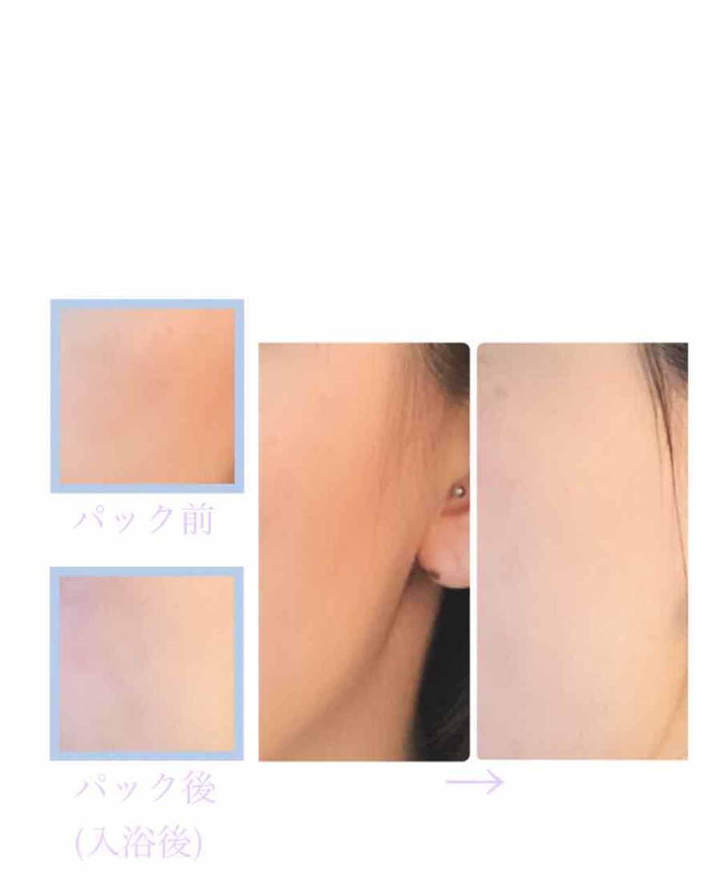 お米のパック/毛穴撫子/洗い流すパック・マスクを使ったクチコミ(2枚目)