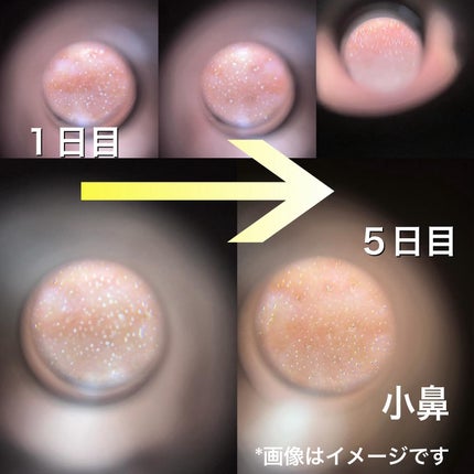 シカレチA エッセンス0.1/VT/美容液を使ったクチコミ(5枚目)