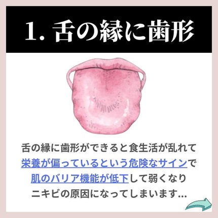 あなたの肌に合ったスキンケア💐コーくん先生 on LIPS 「あなたの肌荒れが治らない原因を突き止めて正しいスキンケアをして..」(6枚目)