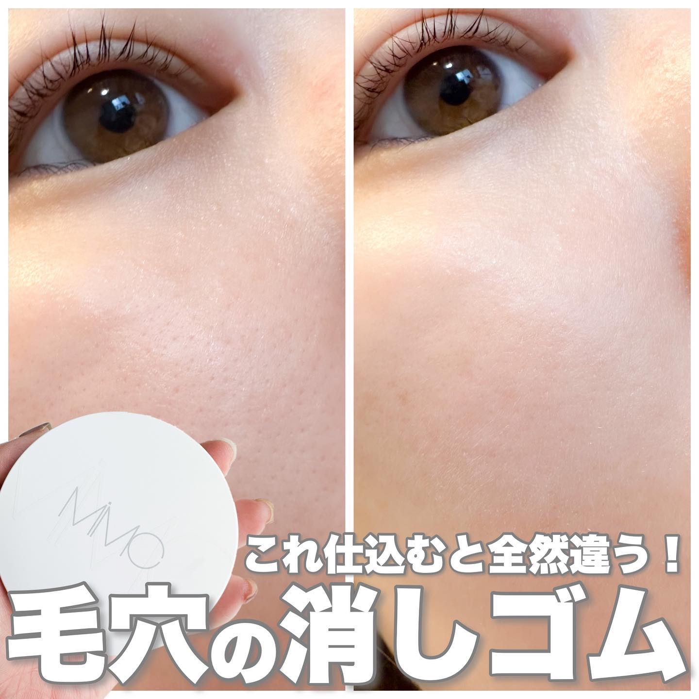 MiMC ミネラルイレイザーバーム SPF20 PA++のクチコミ「毛穴の消しゴム😳‼️

まずは画像を見て貰えばかなり説得力あると思う🙌本当に毛穴が隠れたー❤️.....」（1枚目）