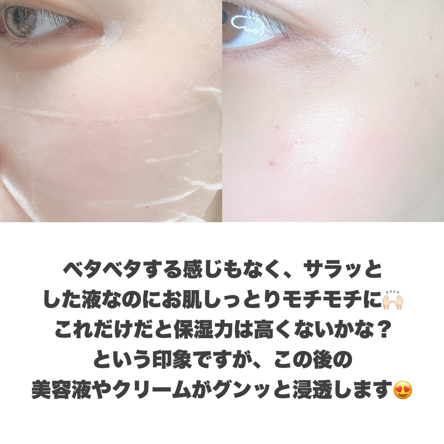 ビタギビング デイリーアクアセラムマスク/ByUR/シートマスク・パックを使ったクチコミ(7枚目)