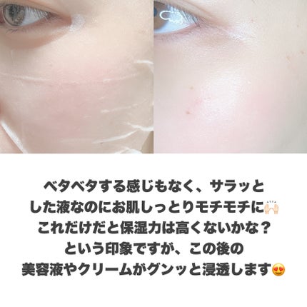 ビタギビング デイリーアクアセラムマスク/ByUR/シートマスク・パックを使ったクチコミ(7枚目)