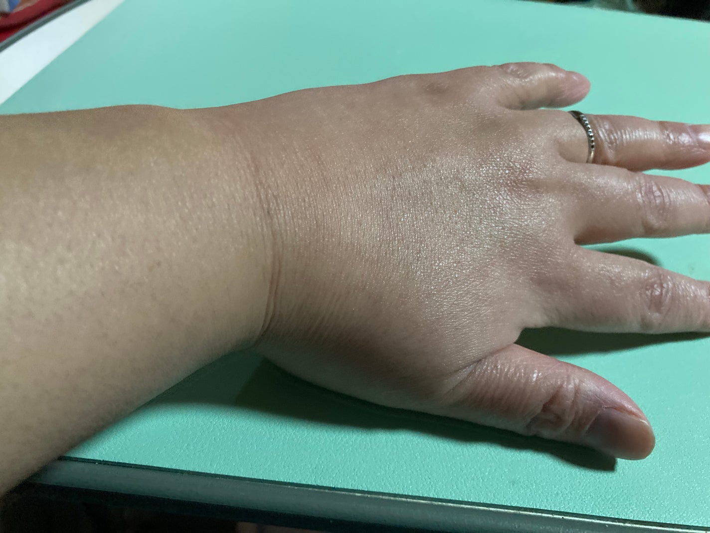 ヒアルーシカ ウォーターフィット サンセラム/SKIN1004/日焼け止めローションを使ったクチコミ(4枚目)