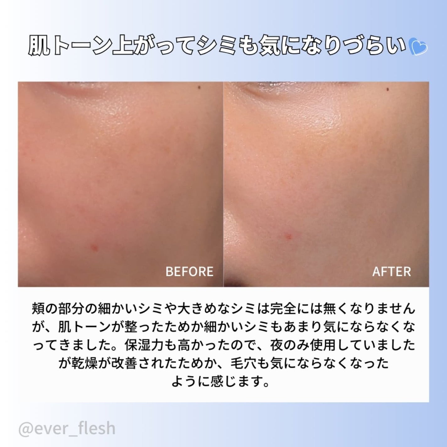 TX-Cream/Dr.Melaxin/フェイスクリームを使ったクチコミ(6枚目)