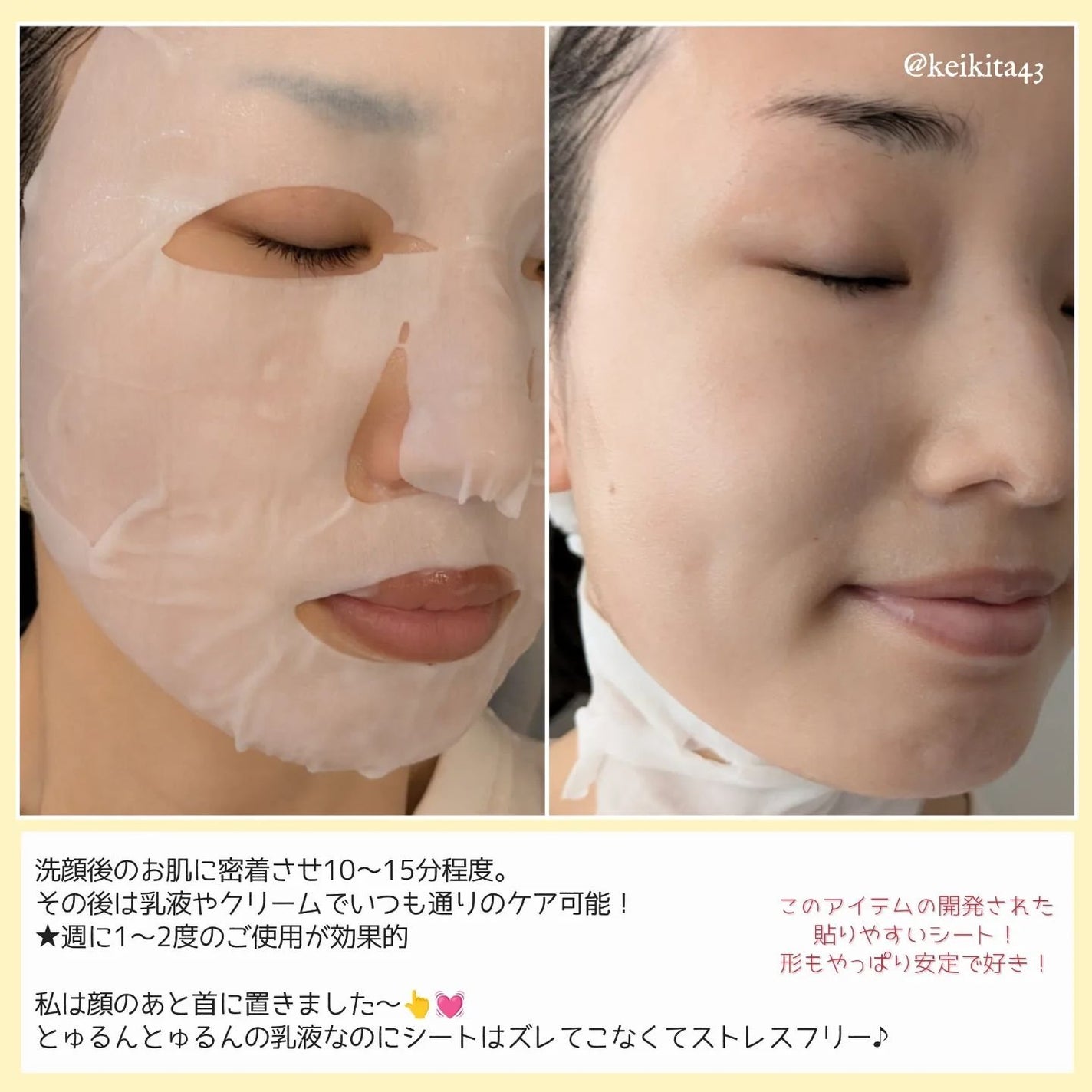 ドクタールルルン スキンブースト EX マスク/ルルルン/シートマスク・パックを使ったクチコミ(3枚目)