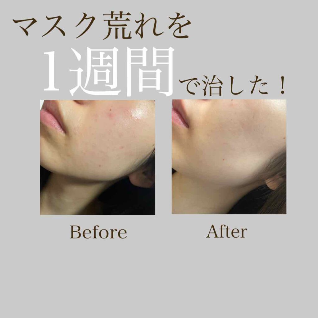 潤浸保湿 化粧水 III とてもしっとり/キュレル/化粧水を使ったクチコミ（1枚目）