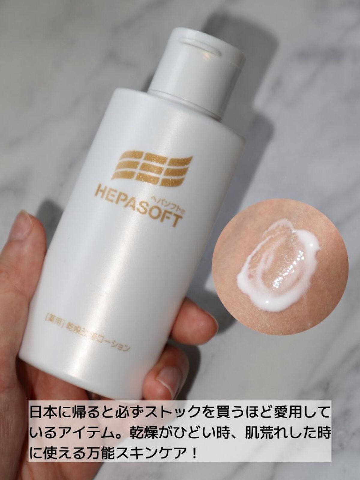 ぬこ on LIPS 「季節の変わり目、ホルモンバランス、食生活の乱れなどで肌荒れした..」(4枚目)