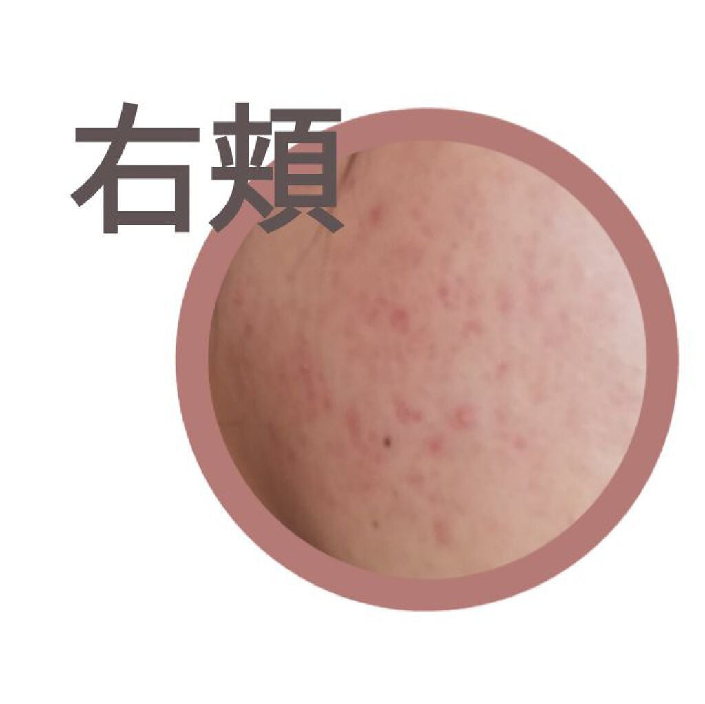 ハトムギ化粧水(ナチュリエ スキンコンディショナー R )/ナチュリエ/化粧水を使ったクチコミ（2枚目）