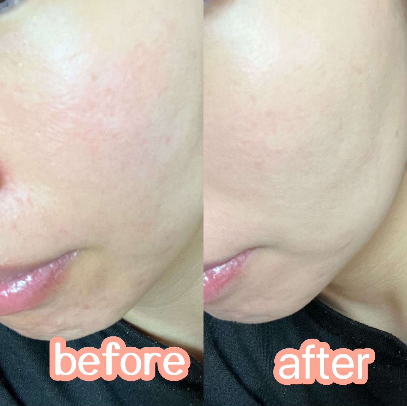 タンイドル ウルトラ ウェア リキッド/LANCOME/リキッドファンデーションを使ったクチコミ（3枚目）