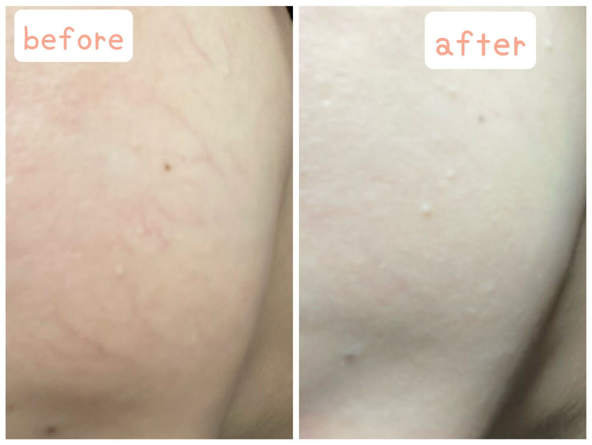 タンイドル ウルトラ ウェア リキッド/LANCOME/リキッドファンデーションを使ったクチコミ（3枚目）