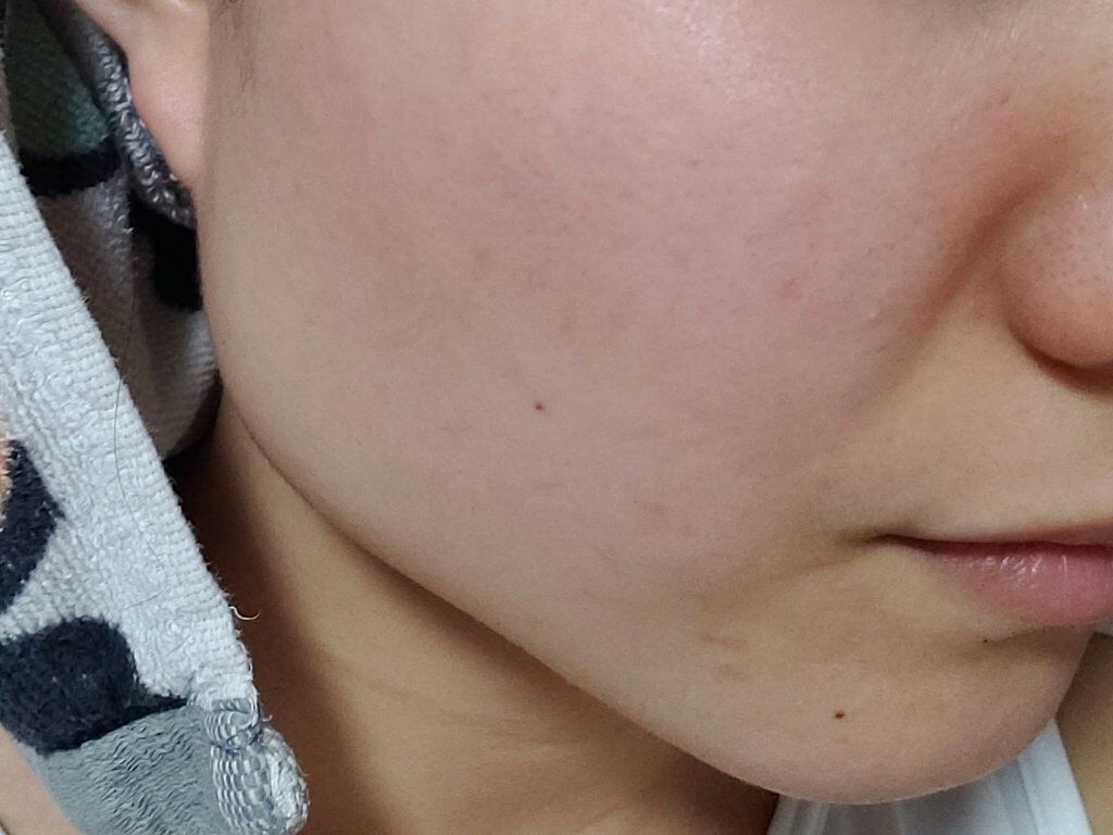 グリーンダーマCICAセラム/ネイチャーリパブリック/美容液を使ったクチコミ(4枚目)