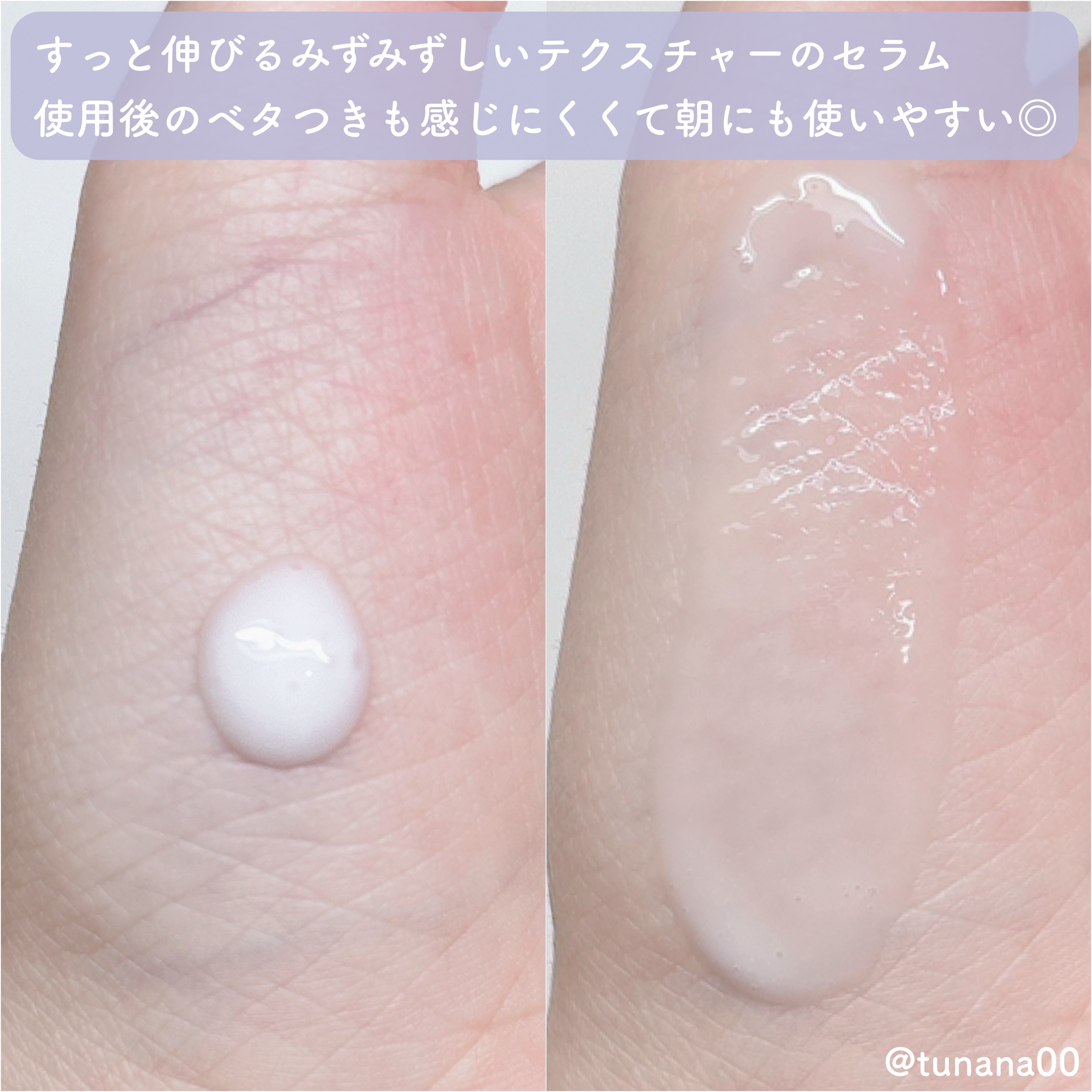 バクチオールポアジェットセラム/Dr.G/美容液を使ったクチコミ（3枚目）