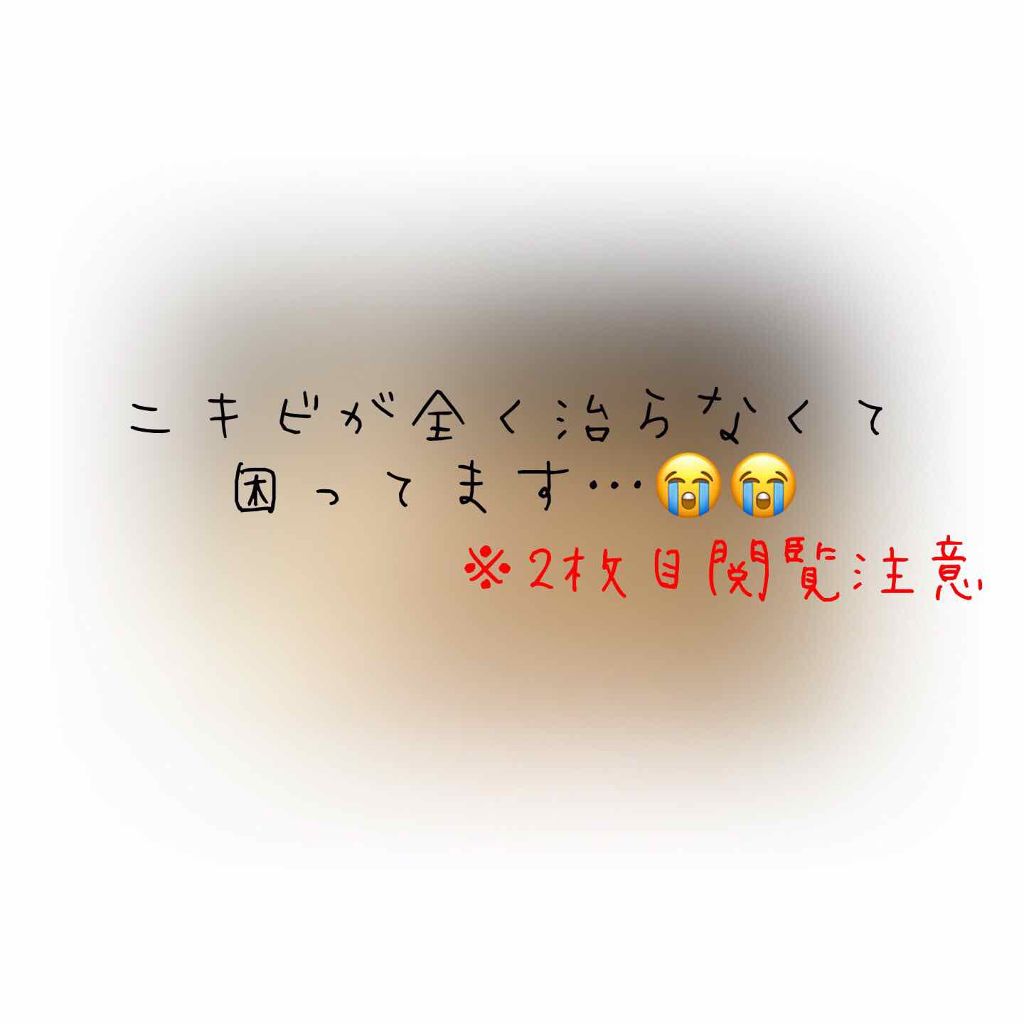 明色美顔水 薬用化粧水/美顔/化粧水を使ったクチコミ(1枚目)