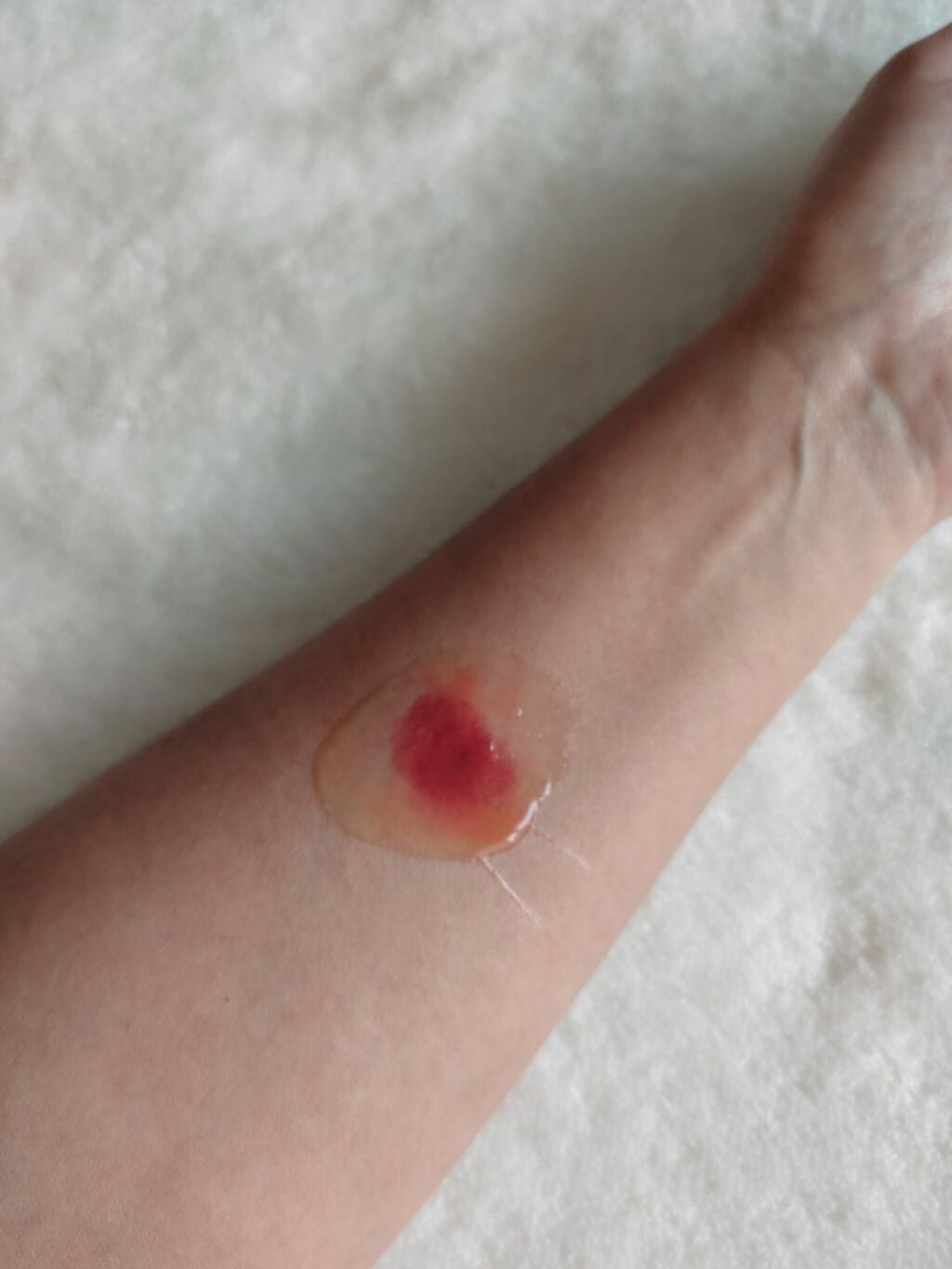 VC100ホットピールクレンジングゲルEX/ドクターシーラボⓇ/クレンジングジェルを使ったクチコミ(3枚目)