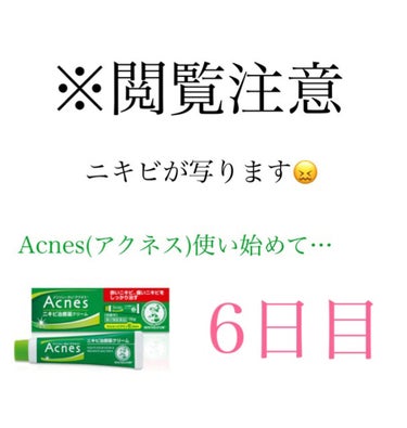 薬用しみ対策 美白化粧水/メラノCC/化粧水を使ったクチコミ（1枚目）