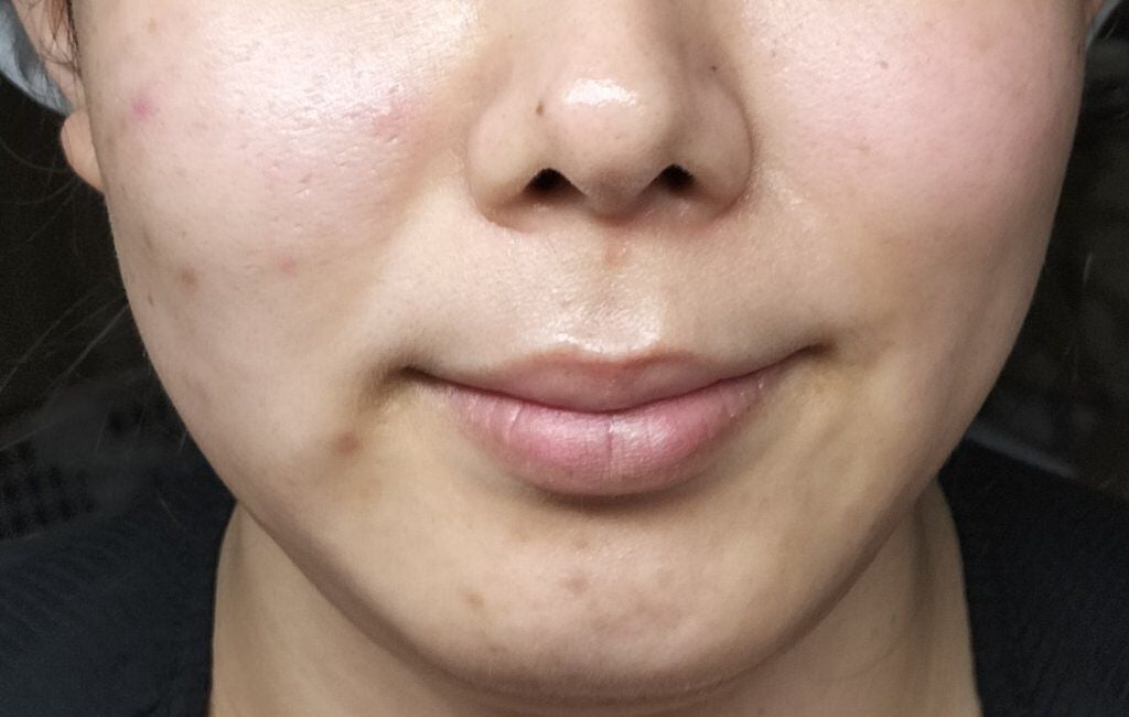 ケシミン浸透化粧水 しっとりタイプ/ケシミン/化粧水を使ったクチコミ(3枚目)