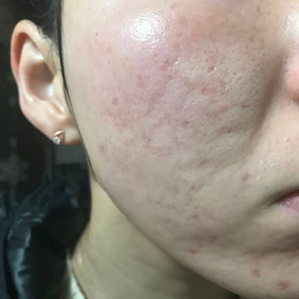 N10+Z1フェイスセラム /The Ordinary/美容液を使ったクチコミ(1枚目)