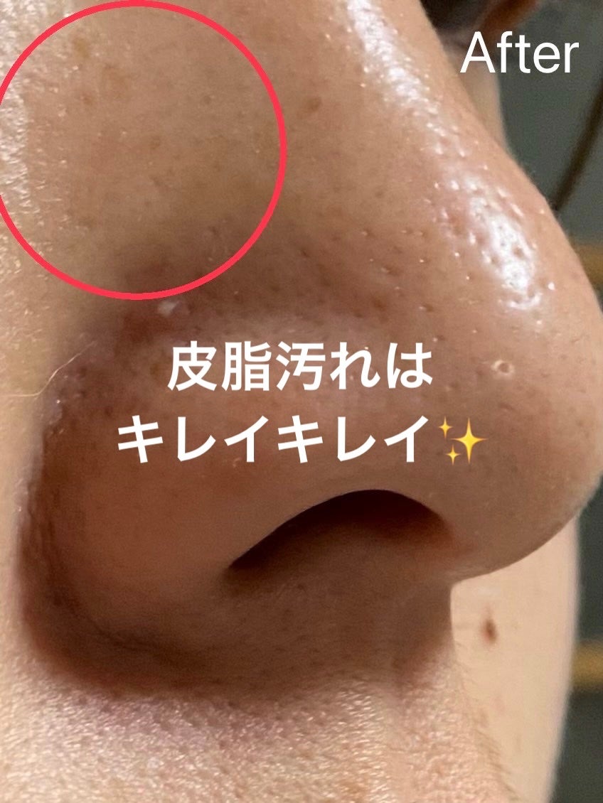 パーフェクトワンフォーカス スムースクレンジングバーム ディープブラック/PERFECT ONE FOCUS/クレンジングバームを使ったクチコミ(6枚目)