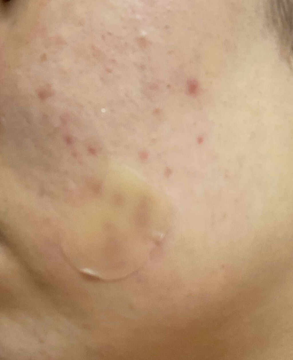 Cセラム/b.glen/美容液を使ったクチコミ（3枚目）