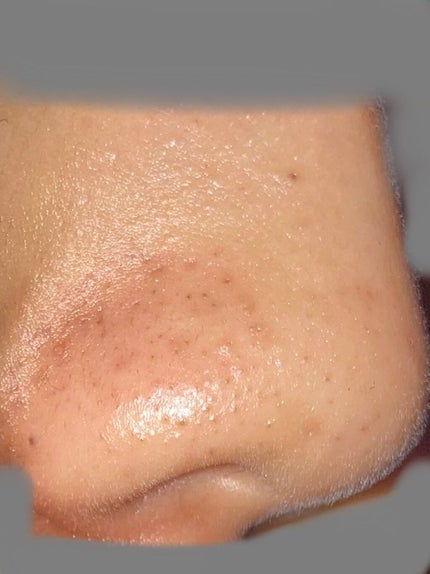 オリジナル ピュアスキンジェリー 200g/ヴァセリン/ボディクリームを使ったクチコミ(2枚目)