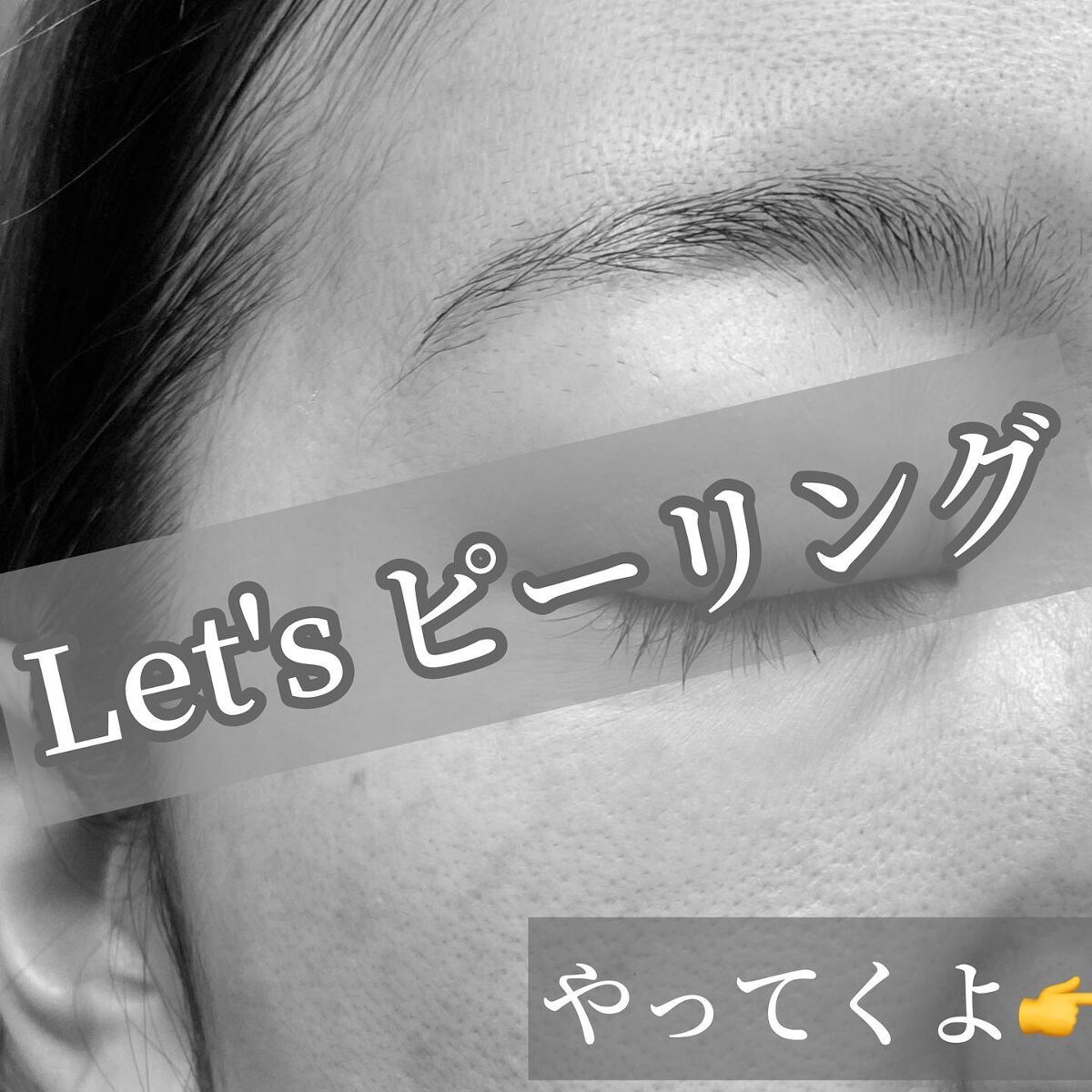 ダーマスキンピーリング/BQCELL/その他キットセットを使ったクチコミ(4枚目)